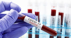 Rize’de Koronavirüs Yasakları