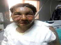 Küçükçekmece’de Sevgilisinin Dehşeti Yaşattığı Kızın Annesi, Yaşananları Anlattı