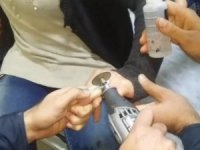 Genç Kadının Parmağına Sıkışan Yüzük Kesilerek Çıkarıldı