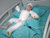 İ̇zmir’de Kolonyalı Vahşet: Eşini Ve Bebeğini Yaktı