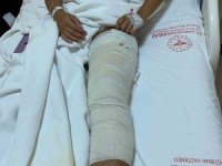 Serinlemek İçin Denize Giren Genç Kızın Ayağına Yorgun Mermi İsabet Etti