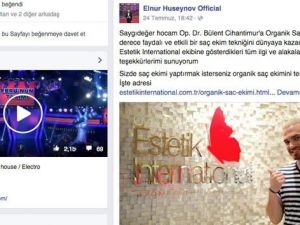 Elnur, Organik Saç Ekimi Sayesinde Beresini Çıkardı