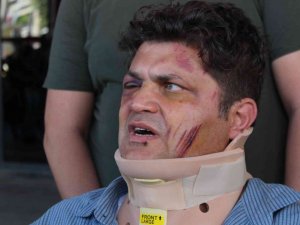 İ̇zmir’de Doktora Sopalı Saldırıda 3 Tutuklama