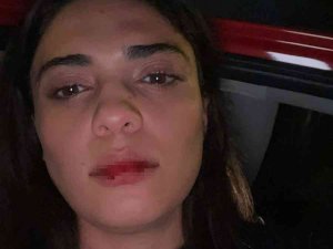 Azerbaycanlı Şarkıcı Nergiz Bagieva, İ̇stanbul’da Taksicinin Saldırısına Uğradı