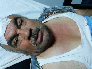 Engelli Koca İle Eşi, Komşularının Taşlı Saldırısında Hastanelik Oldu