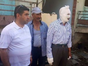 Çorum’da Yangın: 1 Yaralı