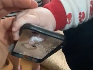 Minik Bebeğin Parmağı Öyle Bir Yere Sıkıştı Ki Gören Şaşkına Döndü