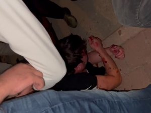 Tacizci Sokak Ortasında Öldüresiye Darp Edildi