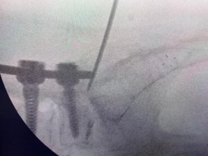 Türk Doktor, Bulduğu Yöntemle Literatüre Girdi