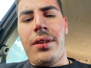 Küçükçekmece’de Kafeye Gelen Müşteri Çalışanı Darp Etti