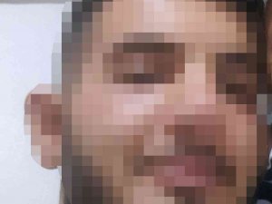 Üvey Annesine Kezzap Döken Genç Tutuklandı