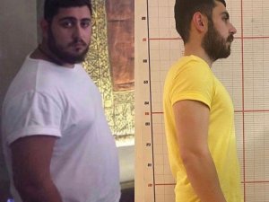 7 Ayda 50 Kilo Verdi, Son Halini Görenler Tanıyamadı