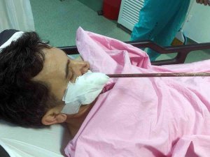 Yüzüne Saplanan Demirle Hastaneye Kaldırıldı