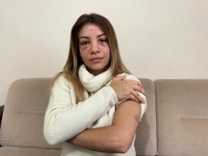 Üsküdar’da Koca Dehşeti: 4 Aylık Hamile Karısını Çocuğunun Gözü Önünde Dövdü