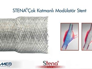 Aort Anevrizmasına Stena Stent Tedavisi