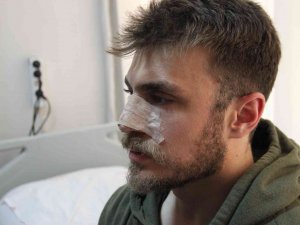 İ̇zmir’de Darp Edilen Asistan Doktorun Burnu Kırıldı