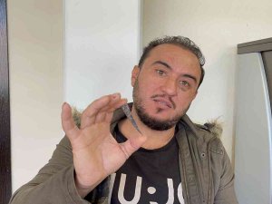 Elinin Acısıyla Gittiği Hastanede Çekilen Röntgenle Hayatının Şokunu Yaşadı