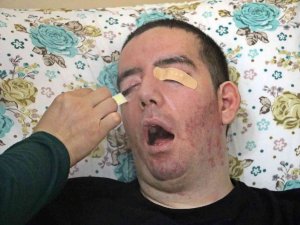 10 Yıldır Gözlerini Bir Kez Bile Kırpamayan Halil, Adeta Kan Ağlıyor