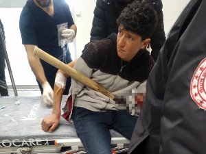 Hayvanlarına Ot Almaya Çalışırken Koluna Yabanın Dişleri Battı