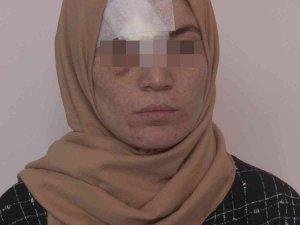 Kocası Darp Etti, 8 Dikiş Atıldı