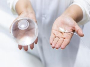 Allurion Elipse Yutulabilir Mide Balonu