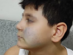 Başkent’te Akran Şiddeti İddiası