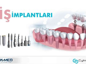 Invamed’in Ürettiği Diş İmplantları Birçok Ülkeye İhraç Ediliyor