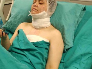 Bayrampaşa’da Dehşet Anları Kamerada: Eski Eşinin Yüzüne Kimyasal Madde Attı