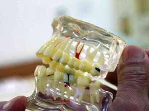 Erzincan’da Sahte Diş Doktoru Vatandaşları Dolandırdı