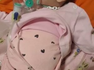 Hastanede Yatan 5 Aylık İkizler Taburcu Oldu