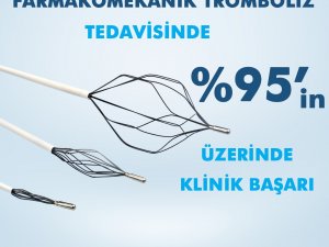 Trellis Tromboliz Sistemi İle Dvt Tedavisinde Yüzde 95’in Üzerinde Klinik Başarı Sağlanıyor