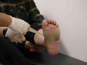 İ̇ş Kazasında Ayağı Koptu 7 Ay Sonra Yürümeye Başladı