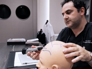 Dr. Levent Acar: "Türkiye Saç Ekiminde Zirvede"