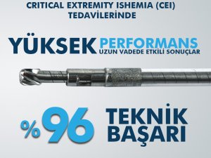 Türkiye’de Yaklaşık 200 Bin Kişi Periferik Arter Hastalığından Muzdarip