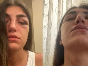 Manken Gizem Akbaş’ın Darp Edilmesine İlişkin Davada Sanığa 1 Yıl Hapis Talebi