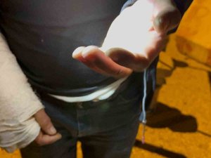 Minibüste Yolculuk Yaparken Elini Koltuğun Arasına Sıkıştırdı