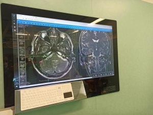 Eskişehir Şehir Hastanesinde İlk Yüz Felci Ameliyatı Gerçekleştirildi