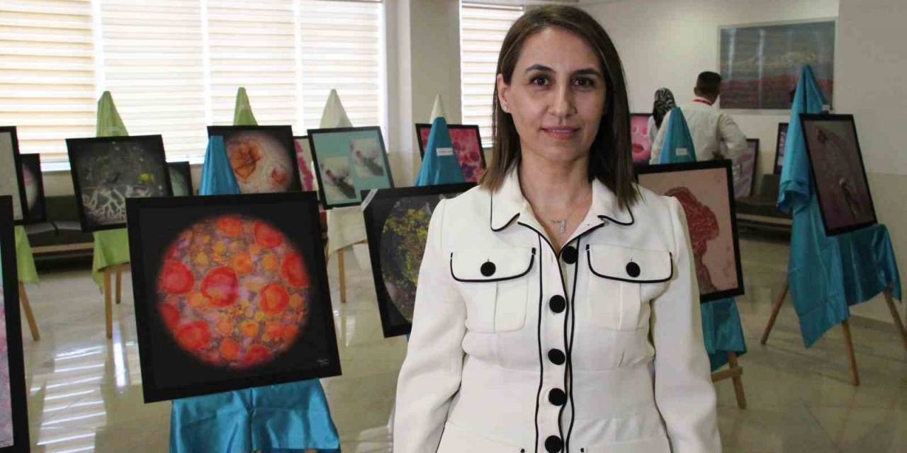 Hastalıklı Dokular Sanat Eserine Dönüştü