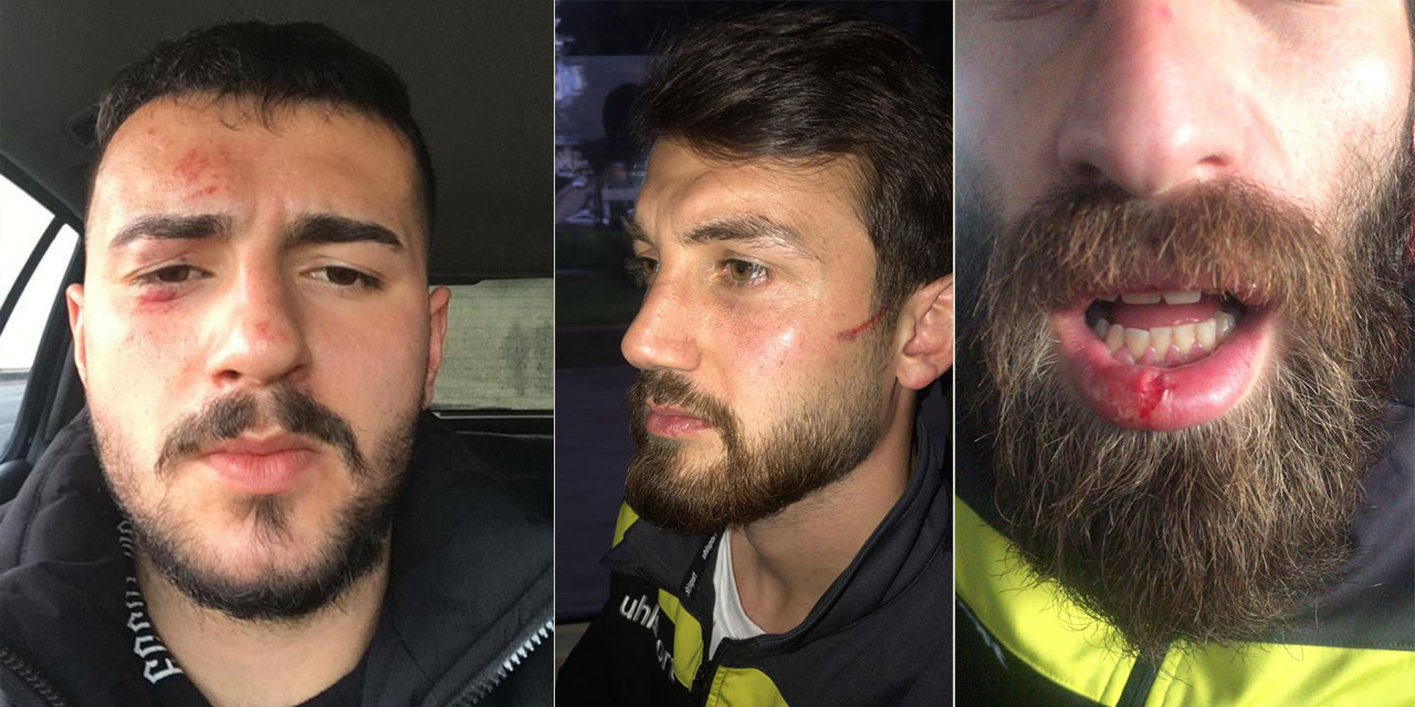 Rize Özel İdaresporlu oyuncular ve yöneticiler Trabzon'da maçta çıkan kavgada yaralandı