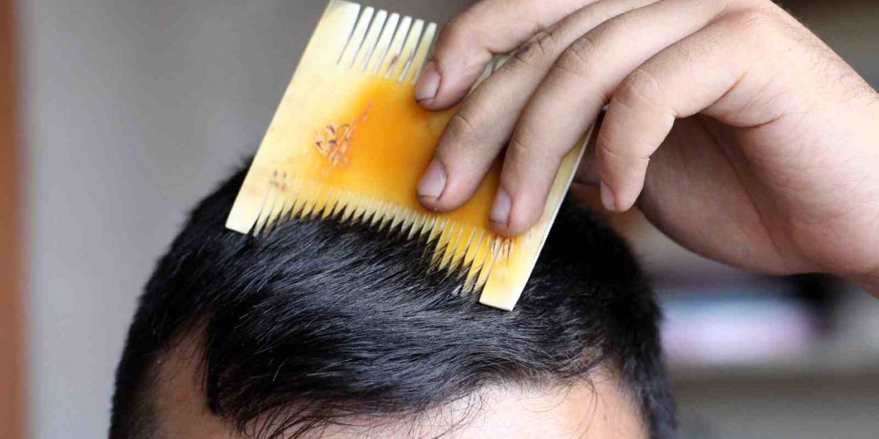 Sivas Kemik Tarağı Coğrafi İşaret Tescili Aldı