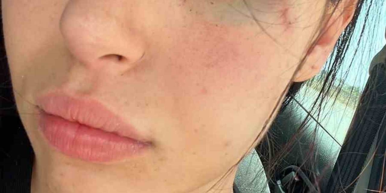 Gkry’da Saldırıya Uğrayan Karaali’nin Duruşması 6 Temmuz’da Yapılacak