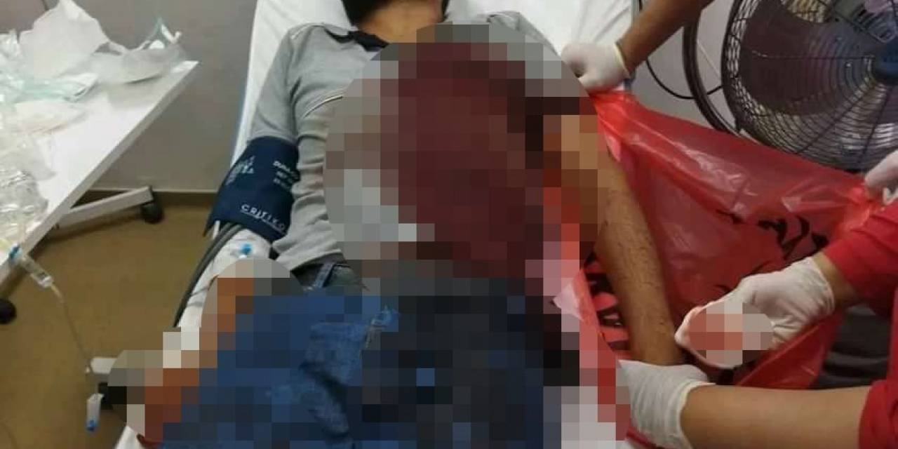Elektrik Sayacı Okuyan Personele Köpek Saldırdı