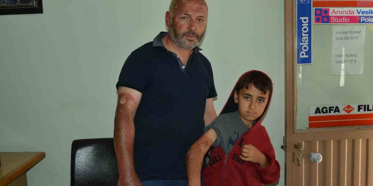 Piknik Alanında Yakılan Çöpler Patladı: 1’i Çocuk 2 Yaralı