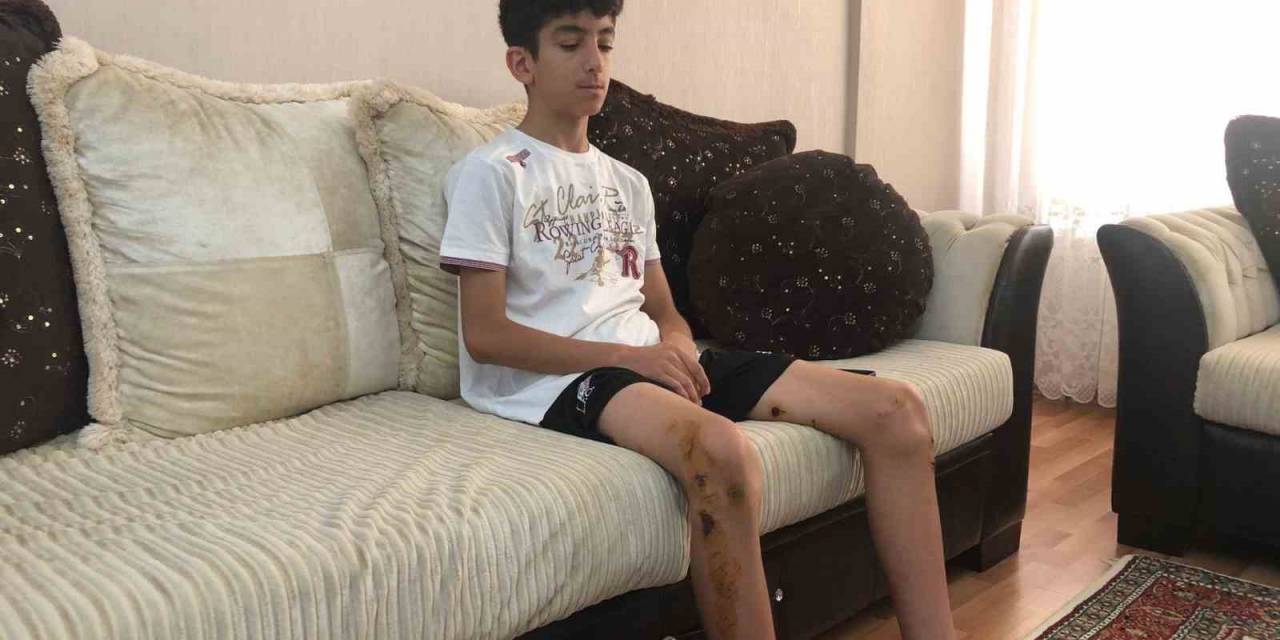 Köpeklerin Saldırdığı 13 Yaşındaki Çocuk Ölümden Döndü