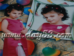 5. Kattan Düştü Ayağı Kırıldı