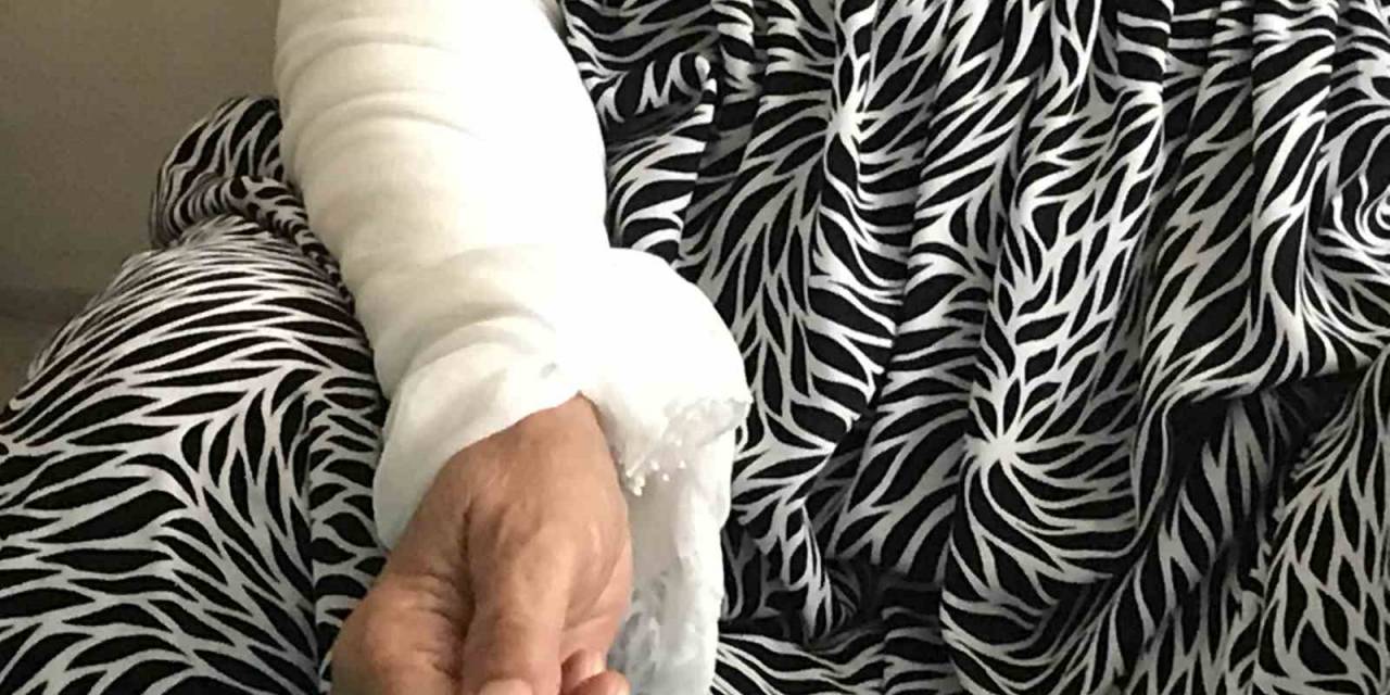 74 Yaşındaki Kadın, Taş Ve Sopalı Saldırıda Darp Edilme Anlarını Anlattı