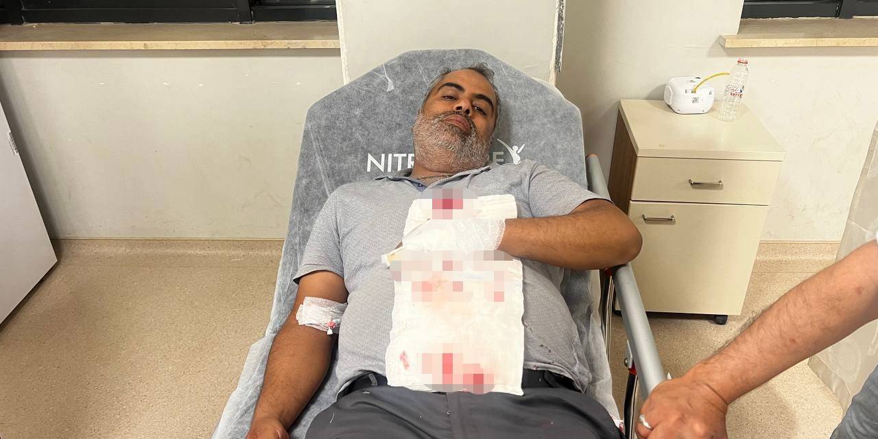 Yorgun Mermi Bahçede Otururken İsabet Etti