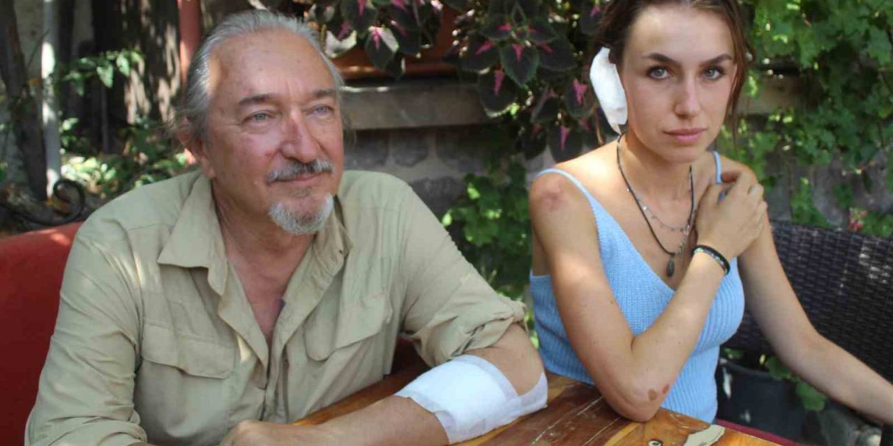 Sokak Köpeği Turistlere Saldırdı: 2 Yaralı