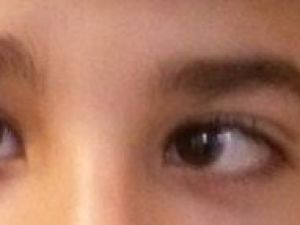 Op. Dr. Yakut: "Şaşılık Her Yaşta Görülebilir"