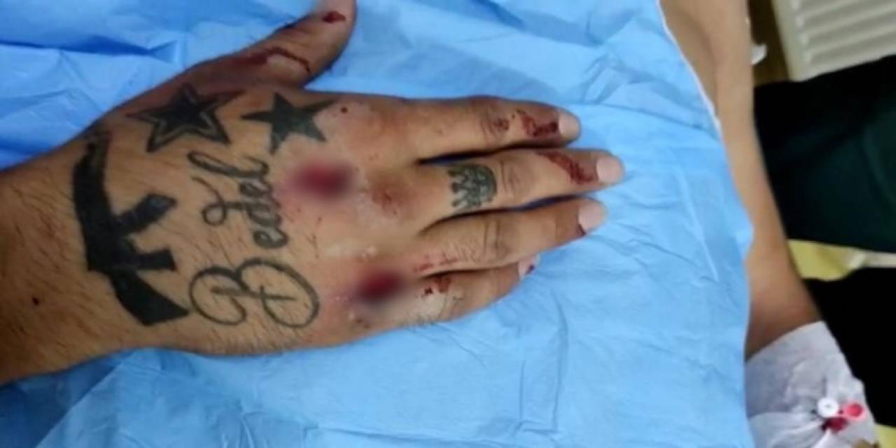 Patnos’ta Ehliyetsiz Motosiklet Sürücüsü Polis Aracına Çarptı